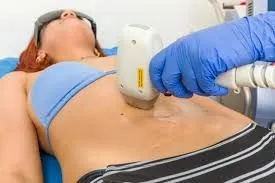 Depilación láser femenina: cuando la tecnología aligera la experiencia estética